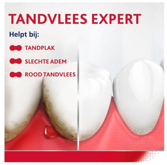 Parodontax Tandpasta bij Bloedend Tandvlees Whitening - 3 x 2 x 75 ml - Voordeelverpakking